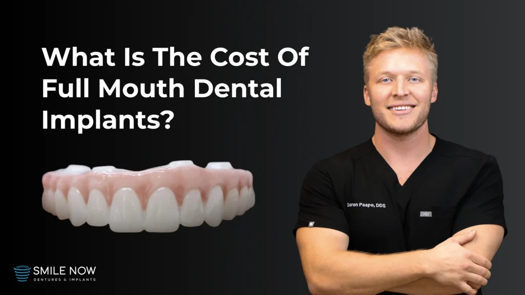 Thumbnail for a video about the cost of full mouth dental implants