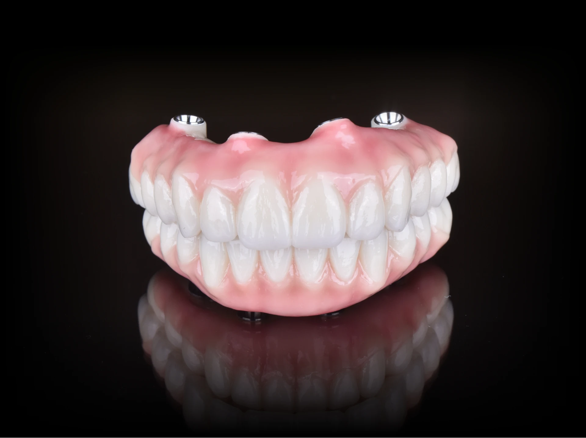 Close-up view of zirconia implant bridges