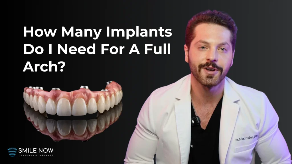 Video thumbnail for full arch implants: how many implants do I need?